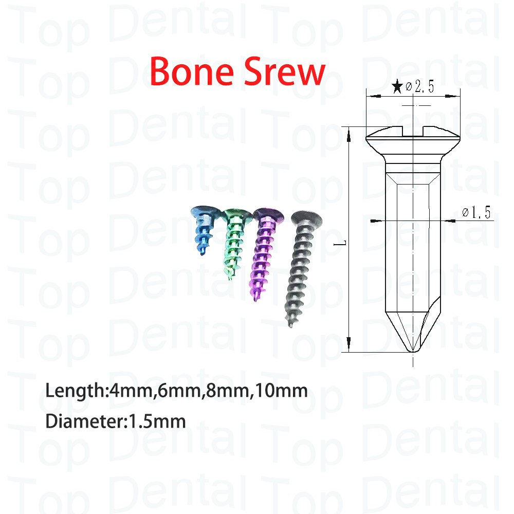 10pcs Dental GBR System Bone S - Stabilizer Screw In 评论和价格